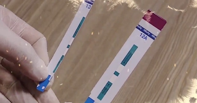 Công an TP. Hà Nội đang kiểm tra, xác minh vụ cắt đôi que thử HIV, viêm gan B tại BV đa khoa Xanh Pôn.(Ảnh Internet)