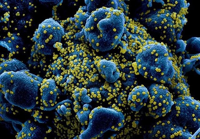 Những nghiên cứu về thuốc điều trị COVID-19 hiện nay tập trung vào việc ngăn chặn virus nhân lên trong cơ thể người.( Ảnh: NIAID).