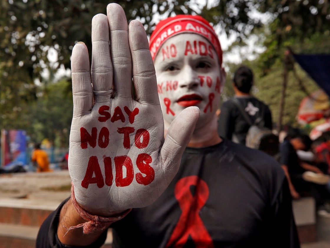 AIDS / HIV (1981 đến nay) Các trường hợp AIDS đầu tiên được biết đến vào năm 1981, nhưng căn bệnh này vẫn tiếp tục lây lan và gây tử vong cho đến ngày nay. Kể từ năm 1981, 75 triệu người đã bị nhiễm vi rút suy giảm miễn dịch ở người (HIV) và khoảng 32 triệu người đã chết vì nó. Là một bệnh lây truyền qua đường tình dục không có thuốc chữa, HIV là một đại dịch dai dẳng và tiếp tục ảnh hưởng đến hàng triệu người mỗi năm. Mặc dù không có cách chữa khỏi bệnh AIDS, nhưng các loại thuốc trong liệu pháp điều trị ARV có thể kiểm soát HIV và làm chậm đáng kể sự tiến triển của nó, cho phép người nhiễm bệnh sống lâu hơn. Ảnh hưởng tiêu cực của AIDS đối với nền kinh tế thế giới vẫn đang được nghiên cứu, đặc biệt là ở châu Phi, châu lục bị ảnh hưởng nặng nề nhất bởi căn bệnh này. Ảnh: Một người đàn ông biểu tình trong chiến dịch nâng cao nhận thức về HIV trước Ngày Thế giới phòng chống AIDS ở Calcutta, Ấn Độ. Reuters