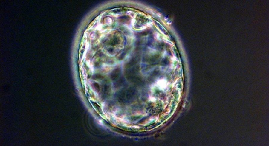 Trong hình là một phôi nang - một trong những giai đoạn đầu tiên của quá trình phát triển phôi, một vài ngày sau khi tế bào trứng và tinh trùng hợp nhất trong quá trình thụ tinh. Một phôi nang người có khoảng 200 tế bào. Và bằng hai phần mười đường kính của sợi tóc.